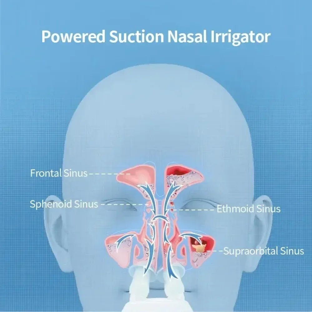 Electric Nasal Rinse Machine – Pulsating Saline Flush System with 50 Pre - Measured SaltPods - Quincelle.co