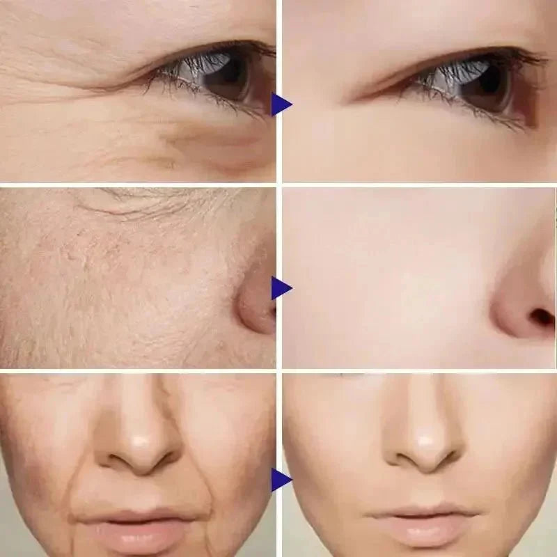 RevitLift™ Retinol Pro - Enrichment Kit | Advanced Firming & Fine Line Recovery - Quincelle.co