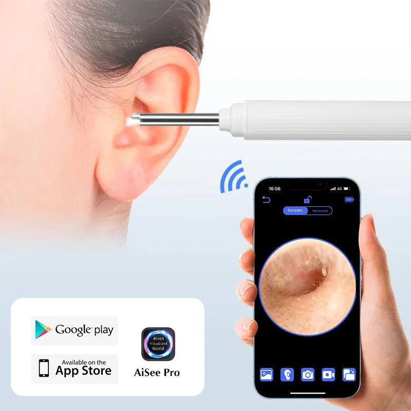 5MP HD Visual Ear Scope with LED Light – Digital Ear Inspection Camera — View 7