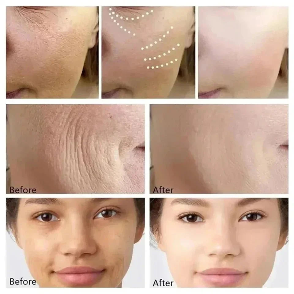 RevitLift™ Retinol Pro - Enrichment Kit | Advanced Firming & Fine Line Recovery - Quincelle.co
