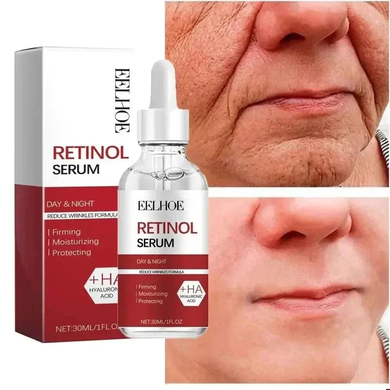 RevitLift™ Retinol Pro - Enrichment Kit | Advanced Firming & Fine Line Recovery - Quincelle.co