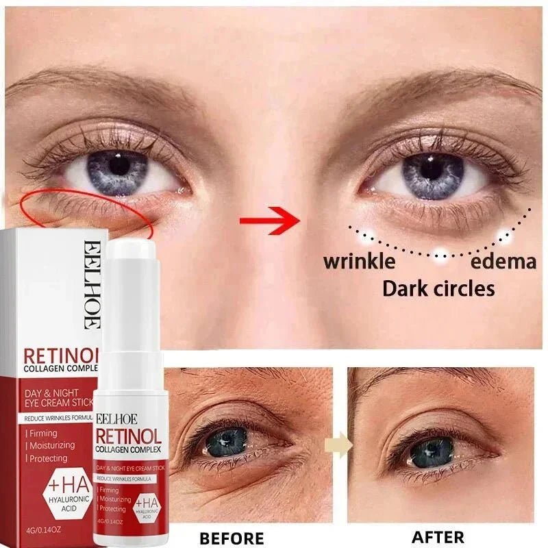RevitLift™ Retinol Pro - Enrichment Kit | Advanced Firming & Fine Line Recovery - Quincelle.co